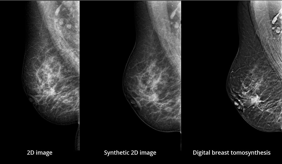 planmed clinical 3d images case 1