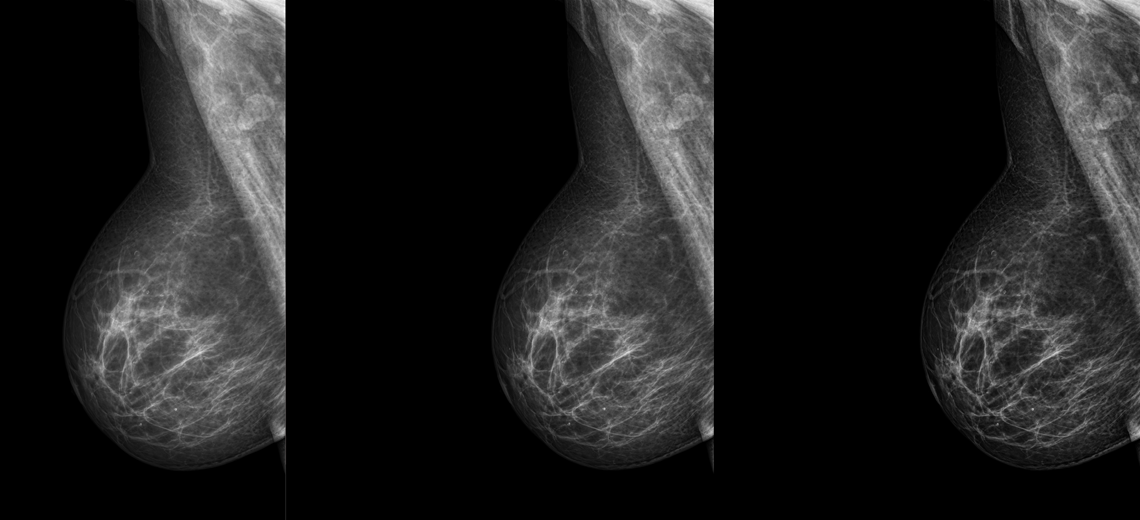 Planmed clinical images post processing