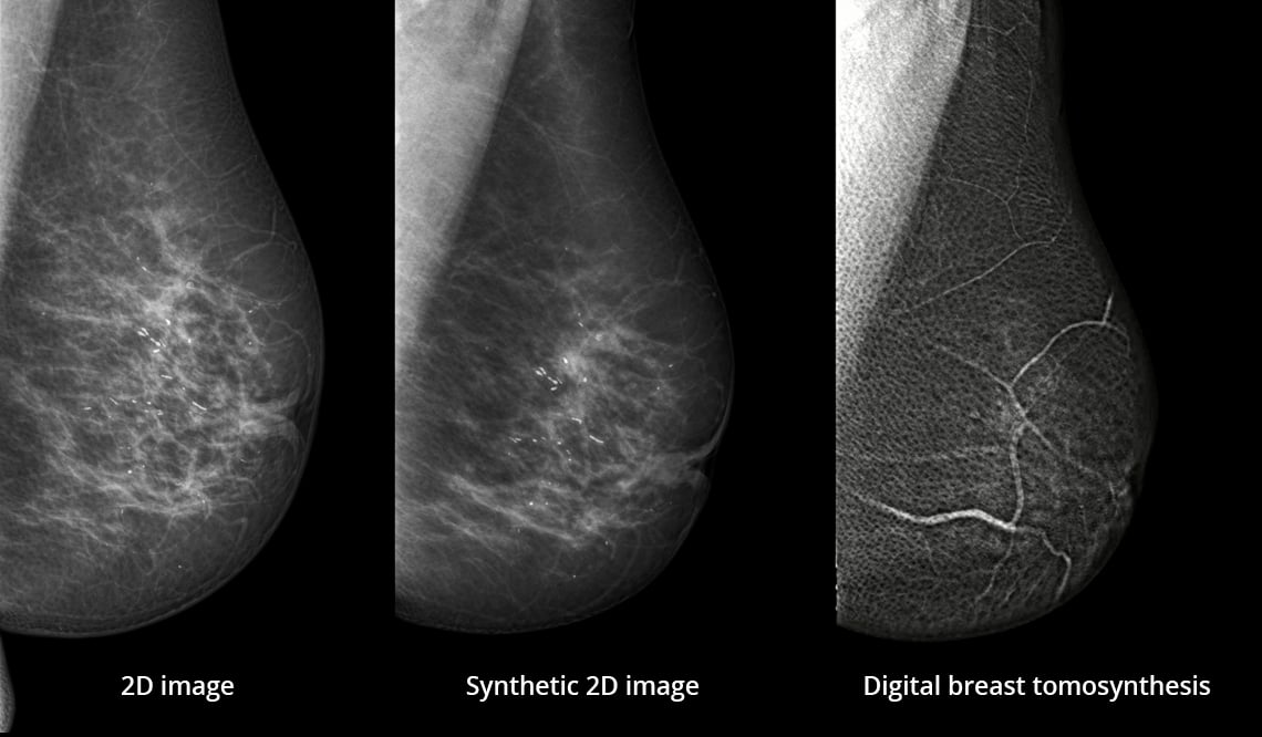 planmed clinical 3d images case 2