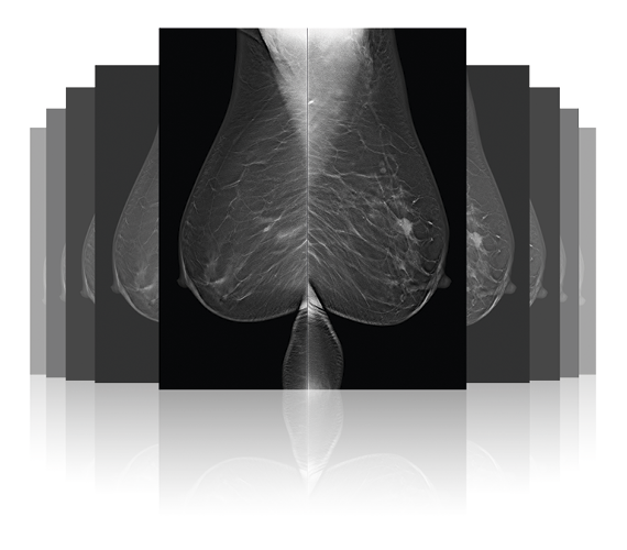 Planmed Clarity 3D clinical image
